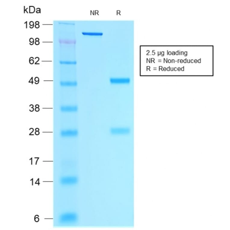 SDS-PAGE - Anti-Estrogen Receptor alpha Antibody [rESR1/1935] (A248473) - Antibodies.com