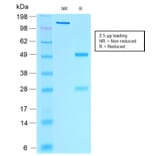 SDS-PAGE - Anti-Estrogen Receptor alpha Antibody [rESR1/1935] (A248473) - Antibodies.com