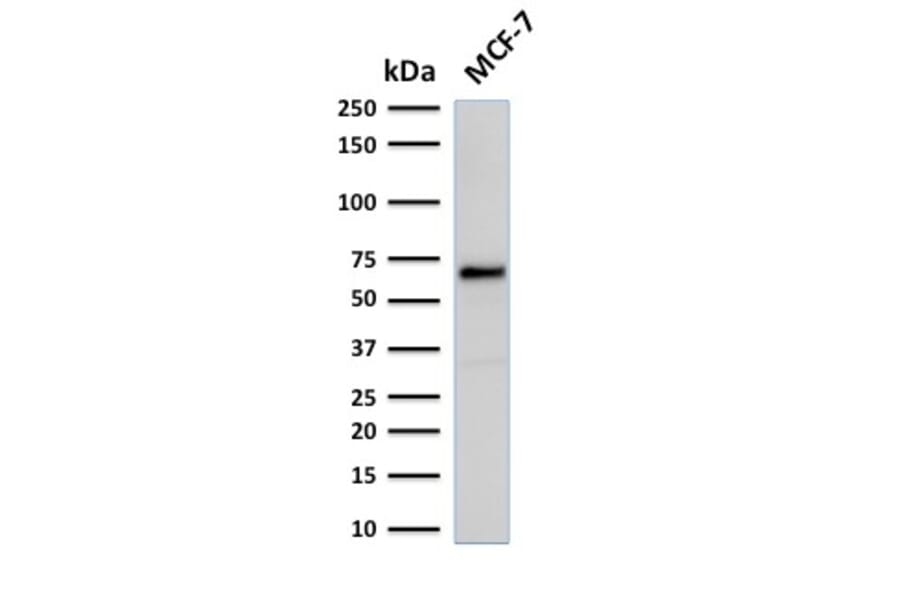 Western Blot - Anti-Estrogen Receptor alpha Antibody [rESR1/1935] (A248473) - Antibodies.com