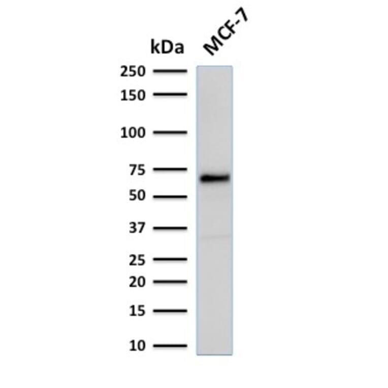 Western Blot - Anti-Estrogen Receptor alpha Antibody [rESR1/1935] (A248473) - Antibodies.com