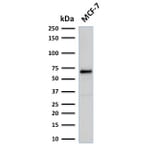 Western Blot - Anti-Estrogen Receptor alpha Antibody [rESR1/1935] (A248473) - Antibodies.com