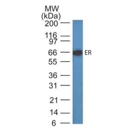 Western Blot - Anti-Estrogen Receptor Antibody [ER505] (A248474) - Antibodies.com