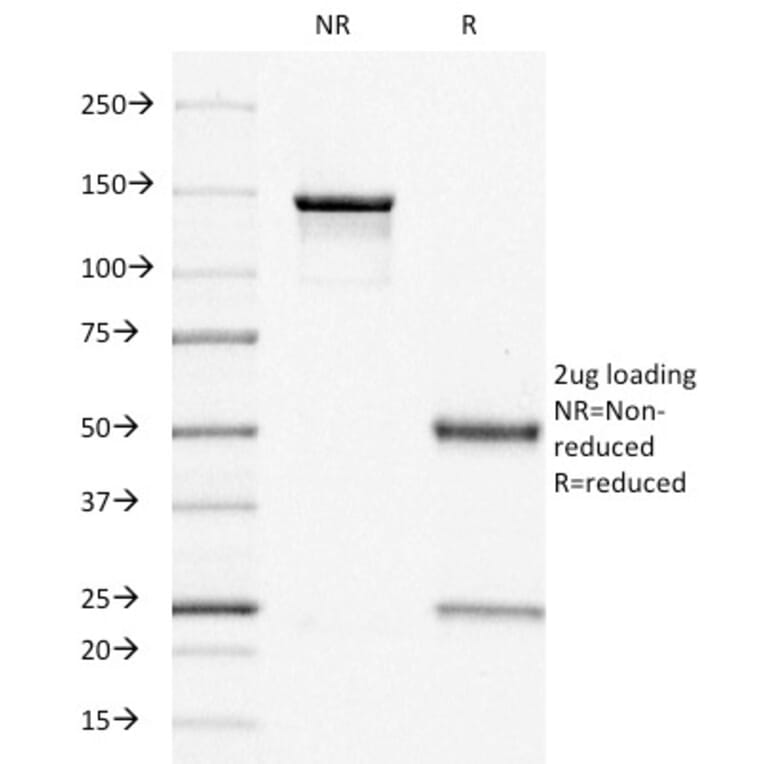 SDS-PAGE - Anti-Estrogen Receptor Antibody [ER505] (A248473) - Antibodies.com