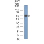 Western Blot - Anti-Estrogen Receptor alpha Antibody [SPM567] (A248474) - Antibodies.com