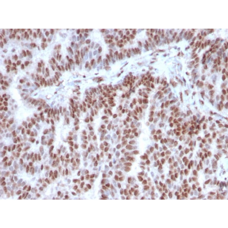 Immunohistochemistry - Anti-Estrogen Receptor alpha Antibody [ESR1/3342] (A248476) - Antibodies.com