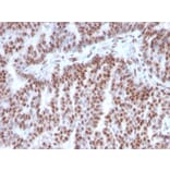 Immunohistochemistry - Anti-Estrogen Receptor alpha Antibody [ESR1/3342] (A248476) - Antibodies.com