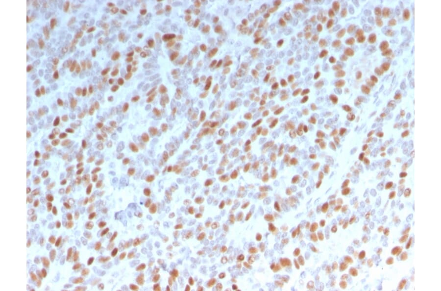 Immunohistochemistry - Anti-Estrogen Receptor alpha Antibody [ESR1/3342] (A248476) - Antibodies.com