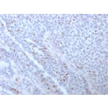 Immunohistochemistry - Anti-Estrogen Receptor alpha Antibody [ESR1/3373] (A248477) - Antibodies.com