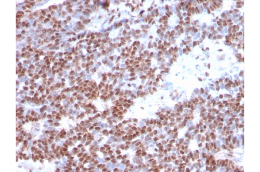Immunohistochemistry - Anti-Estrogen Receptor alpha Antibody [ESR1/3373] (A248477) - Antibodies.com