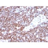 Immunohistochemistry - Anti-Estrogen Receptor alpha Antibody [ESR1/3373] (A248477) - Antibodies.com