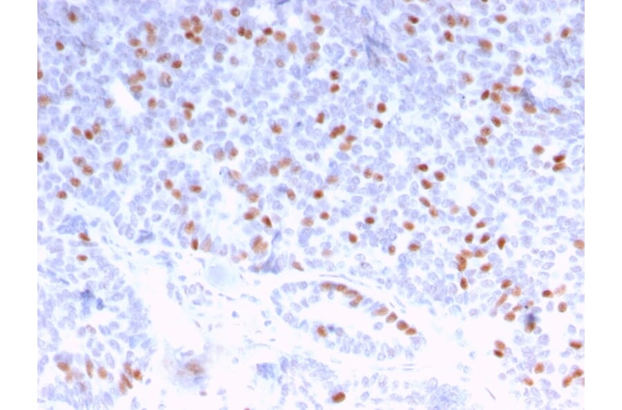 Immunohistochemistry - Anti-Estrogen Receptor alpha Antibody [ESR1/3373] (A248477) - Antibodies.com