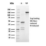 SDS-PAGE - Anti-Estrogen Receptor alpha Antibody [ESR1/3373] (A248477) - Antibodies.com