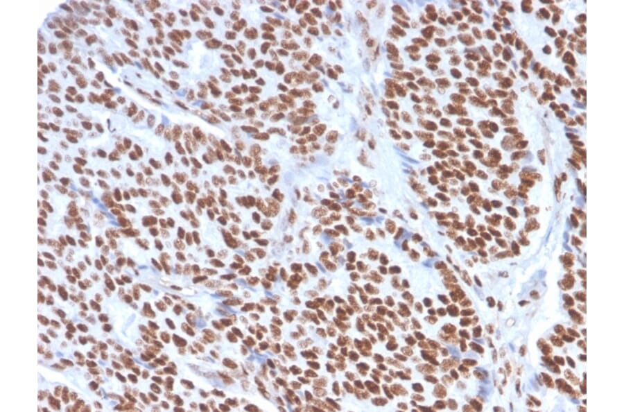 Immunohistochemistry - Anti-Estrogen Receptor alpha Antibody [ESR1/3557] (A248479) - Antibodies.com