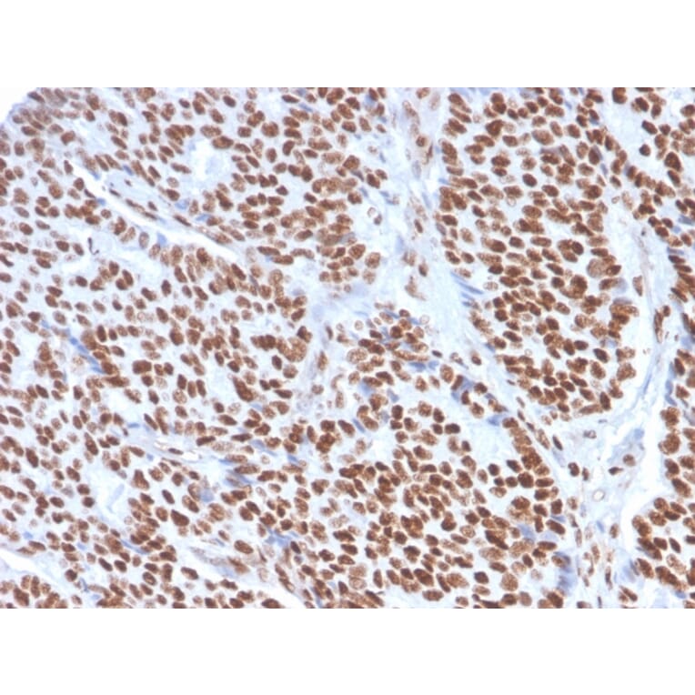 Immunohistochemistry - Anti-Estrogen Receptor alpha Antibody [ESR1/3557] (A248479) - Antibodies.com