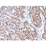 Immunohistochemistry - Anti-Estrogen Receptor alpha Antibody [ESR1/3557] (A248479) - Antibodies.com
