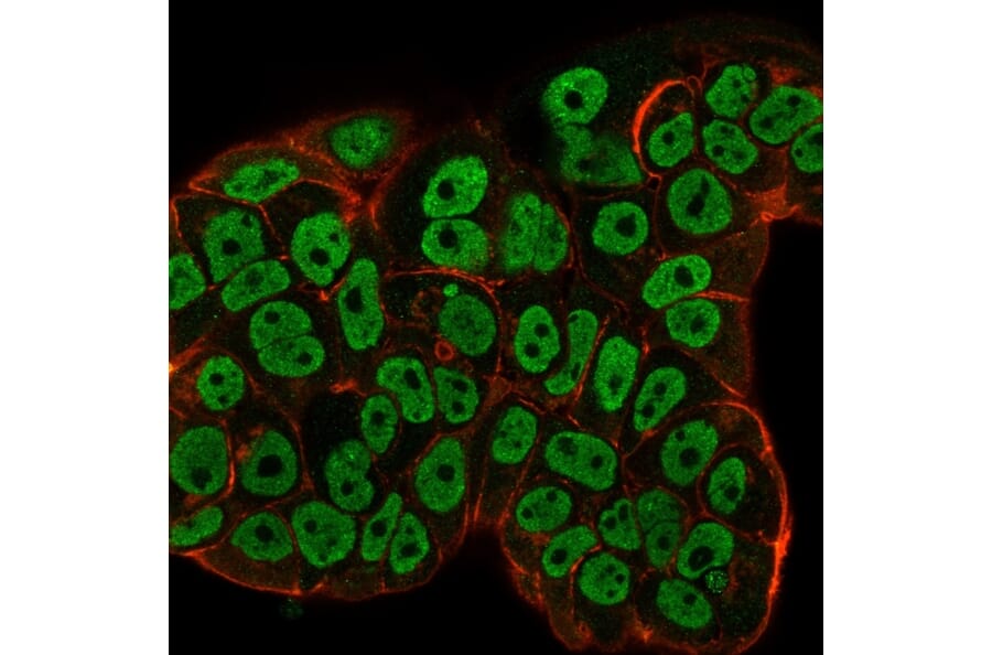 Immunofluorescence - Anti-Estrogen Receptor alpha Antibody [ESR1/3557] (A248479) - Antibodies.com