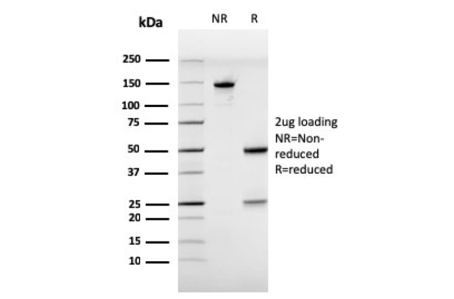 SDS-PAGE - Anti-Estrogen Receptor alpha Antibody [ESR1/3557] (A248479) - Antibodies.com