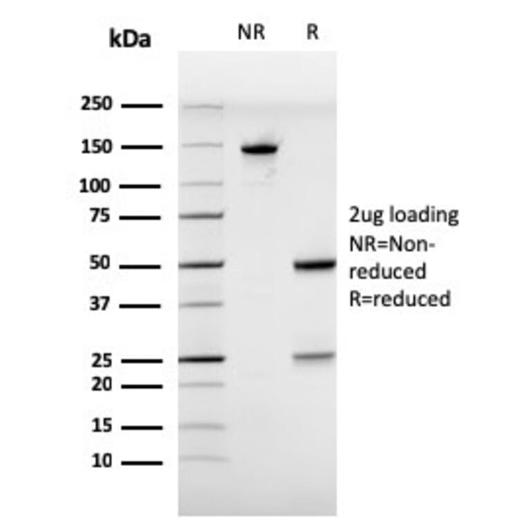 SDS-PAGE - Anti-Estrogen Receptor alpha Antibody [ESR1/3557] (A248479) - Antibodies.com