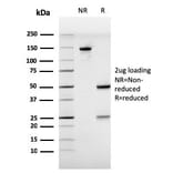 SDS-PAGE - Anti-Estrogen Receptor alpha Antibody [ESR1/3557] (A248479) - Antibodies.com