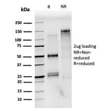 SDS-PAGE - Anti-Estrogen Receptor alpha Antibody [ESR1/3559] (A248480) - Antibodies.com