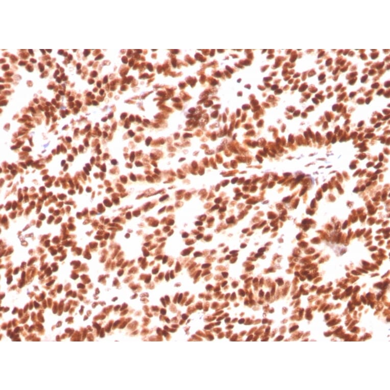 Immunohistochemistry - Anti-Estrogen Receptor alpha Antibody [ESR1/3559] (A248480) - Antibodies.com