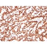 Immunohistochemistry - Anti-Estrogen Receptor alpha Antibody [ESR1/3559] (A248480) - Antibodies.com