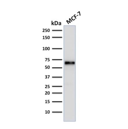 Western Blot - Anti-Estrogen Receptor alpha Antibody [ER506] (A248481) - Antibodies.com
