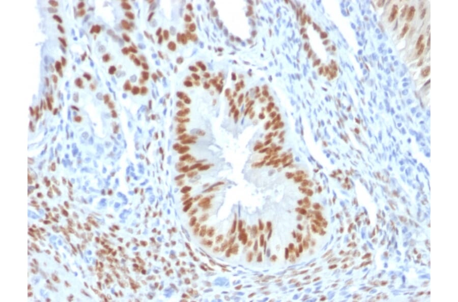 Immunohistochemistry - Anti-Estrogen Receptor alpha Antibody [ER506] (A248481) - Antibodies.com