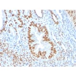 Immunohistochemistry - Anti-Estrogen Receptor alpha Antibody [ER506] (A248481) - Antibodies.com