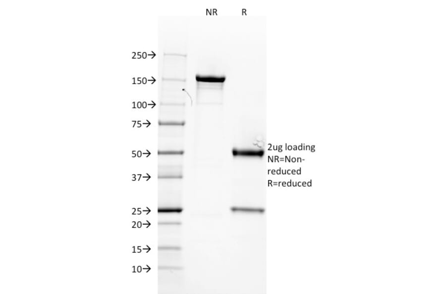 SDS-PAGE - Anti-Estrogen Receptor alpha Antibody [ER506] (A248481) - Antibodies.com