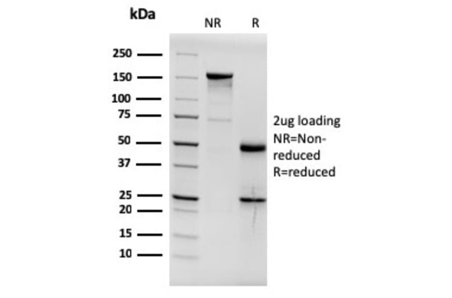 SDS-PAGE - Anti-Estrogen Receptor alpha Antibody [ESR1/3564] (A248482) - Antibodies.com