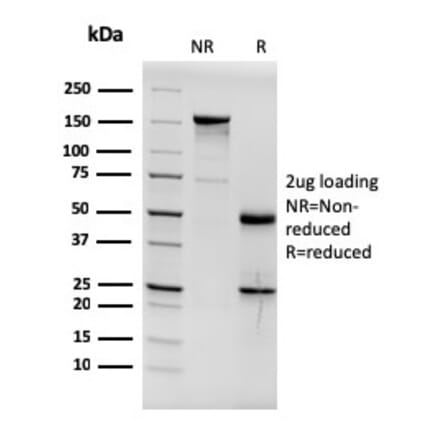SDS-PAGE - Anti-Estrogen Receptor alpha Antibody [ESR1/3564] (A248482) - Antibodies.com