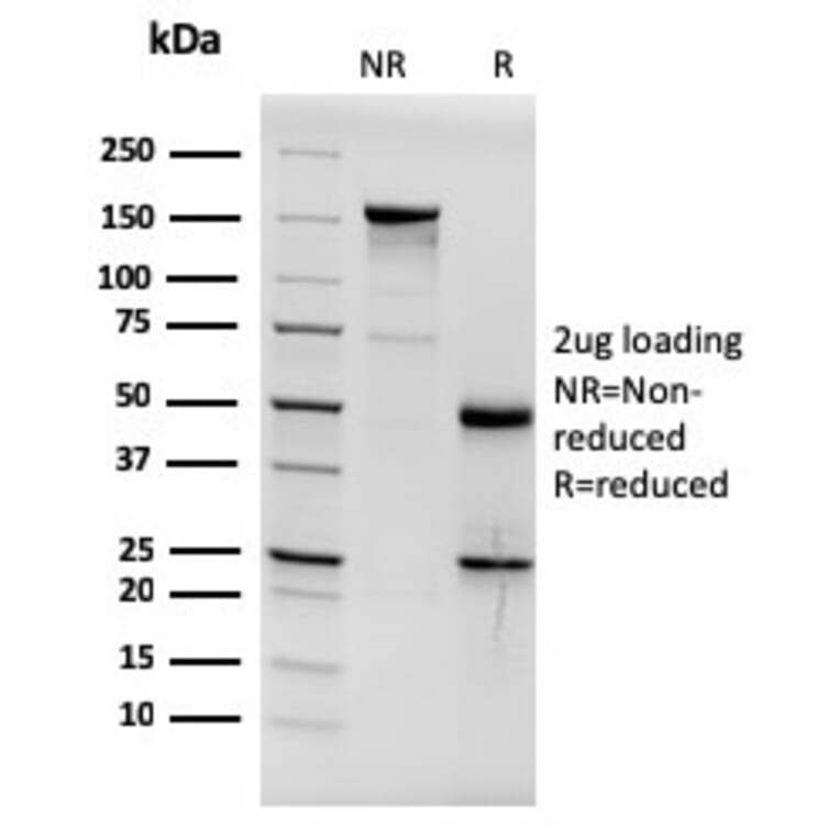 SDS-PAGE - Anti-Estrogen Receptor alpha Antibody [ESR1/3564] (A248482) - Antibodies.com