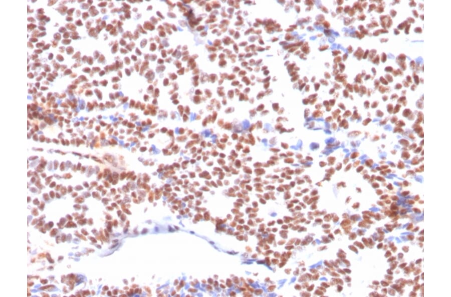 Immunohistochemistry - Anti-Estrogen Receptor alpha Antibody [ESR1/3564] (A248482) - Antibodies.com