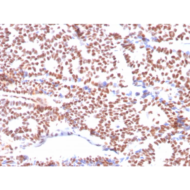 Immunohistochemistry - Anti-Estrogen Receptor alpha Antibody [ESR1/3564] (A248482) - Antibodies.com