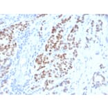 Immunohistochemistry - Anti-Estrogen Receptor alpha Antibody [ESR1/4008] (A248484) - Antibodies.com