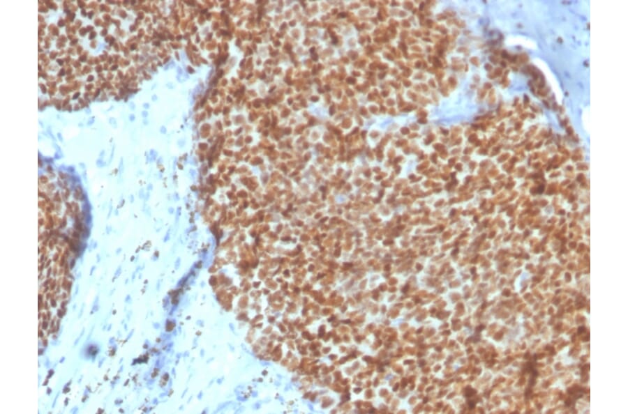 Immunohistochemistry - Anti-Estrogen Receptor alpha Antibody [ESR1/4008] (A248484) - Antibodies.com