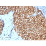 Immunohistochemistry - Anti-Estrogen Receptor alpha Antibody [ESR1/4008] (A248484) - Antibodies.com