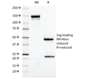SDS-PAGE - Anti-Estrogen Receptor Antibody [ESR1/420] (A248484) - Antibodies.com