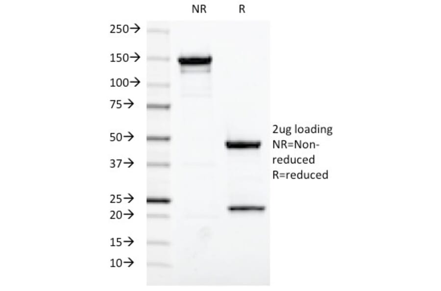 SDS-PAGE - Anti-Estrogen Receptor Antibody [ESR1/420] (A248484) - Antibodies.com