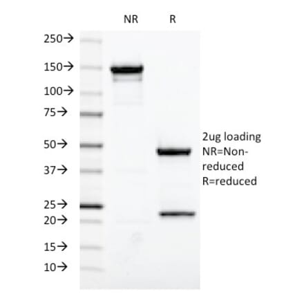 SDS-PAGE - Anti-Estrogen Receptor Antibody [ESR1/420] (A248484) - Antibodies.com