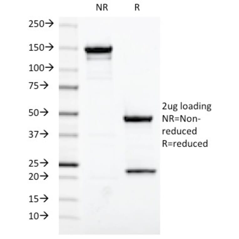 SDS-PAGE - Anti-Estrogen Receptor Antibody [ESR1/420] (A248484) - Antibodies.com