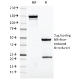 SDS-PAGE - Anti-Estrogen Receptor Antibody [ESR1/420] (A248484) - Antibodies.com