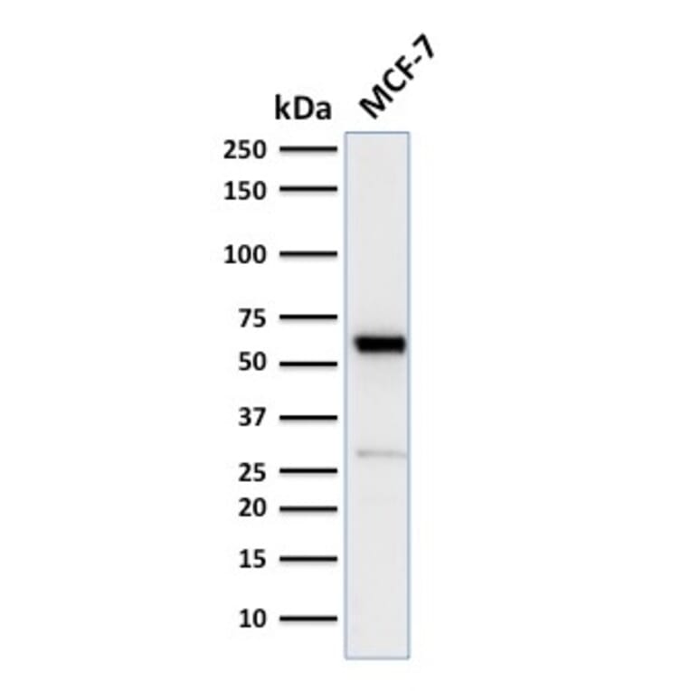 Western Blot - Anti-Estrogen Receptor alpha Antibody [ESR1/2299R] (A248486) - Antibodies.com