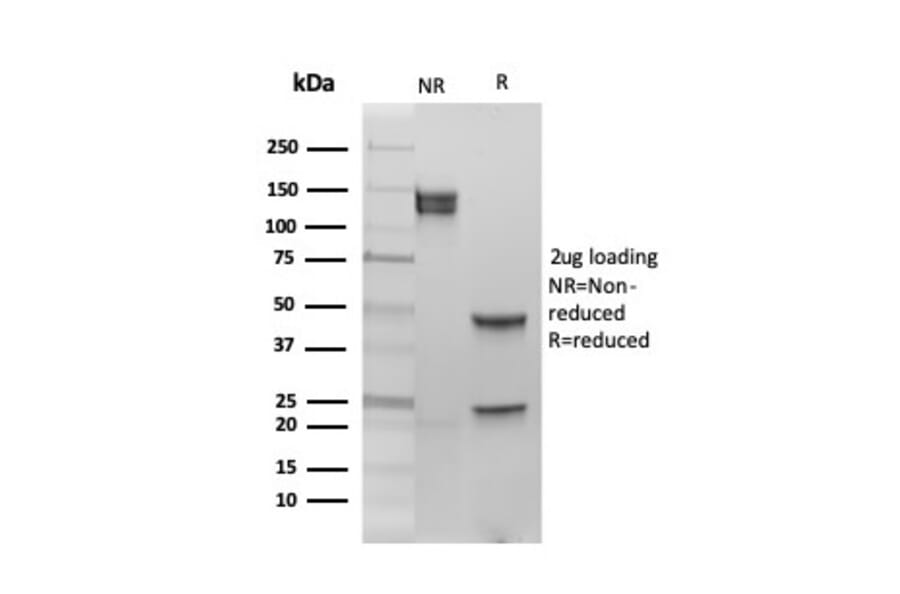 SDS-PAGE - Anti-Estrogen Receptor beta 1 Antibody [PGP5/10] (A248487) - Antibodies.com