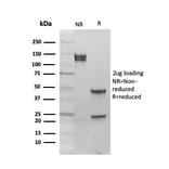 SDS-PAGE - Anti-Estrogen Receptor beta 1 Antibody [PGP5/10] (A248487) - Antibodies.com