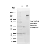 SDS-PAGE - Anti-Estrogen Receptor beta 2 Antibody [57/3] (A248488) - Antibodies.com