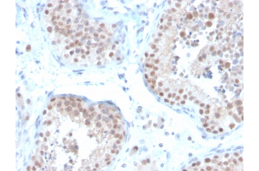 Immunohistochemistry - Anti-Estrogen Receptor beta 2 Antibody [57/3] (A248488) - Antibodies.com