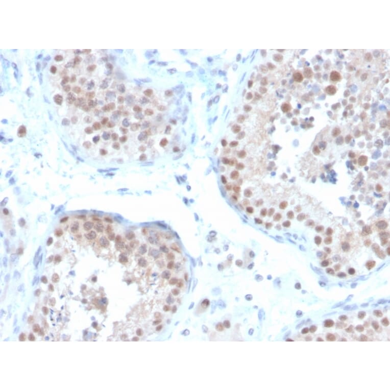 Immunohistochemistry - Anti-Estrogen Receptor beta 2 Antibody [57/3] (A248488) - Antibodies.com