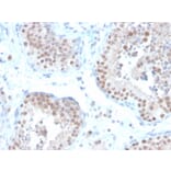 Immunohistochemistry - Anti-Estrogen Receptor beta 2 Antibody [57/3] (A248488) - Antibodies.com